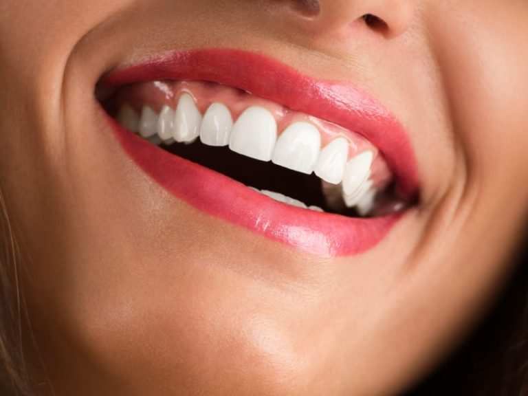 Strategies to Prevent Tonsil Gemstones