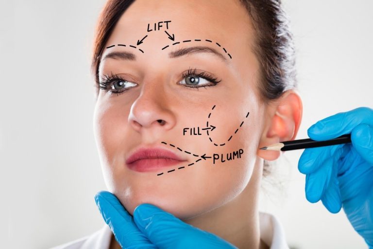 The Types And Benefits Of Facelift Surgery