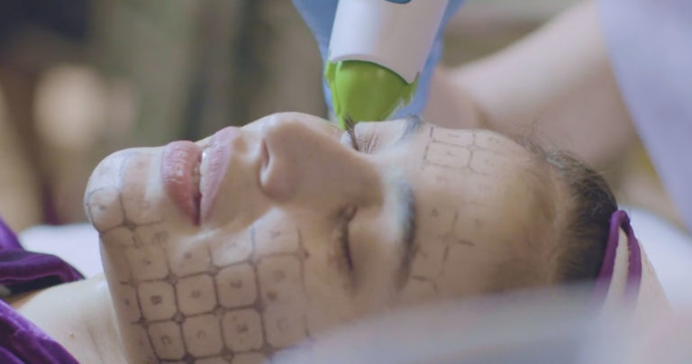 How Does Thermage Differ from Other Skin Tightening Treatments?