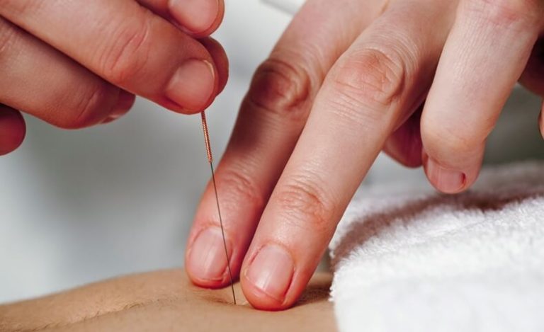 How Does Acupuncture Work?