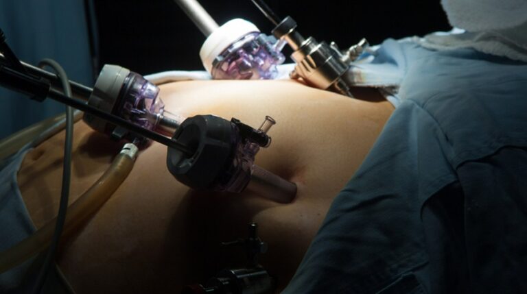 Comparing Gastric Sleeve to Other Bariatric Procedures: Which is Right for You?