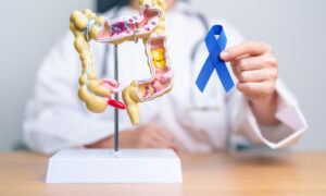 10 Warning Signs of Colon Cancer You Shouldn’t Ignore