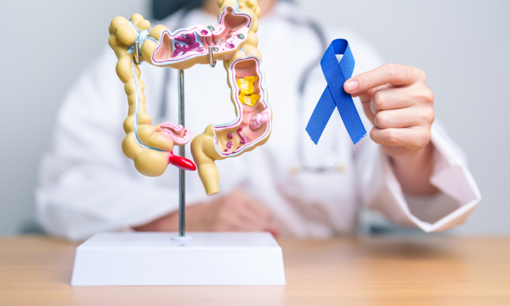 10 Warning Signs of Colon Cancer You Shouldn’t Ignore