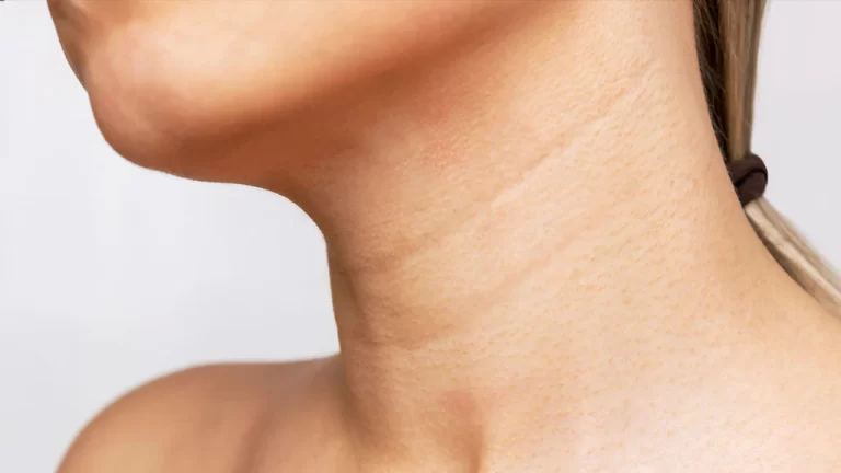 Understanding Neck Lines And Modern Life