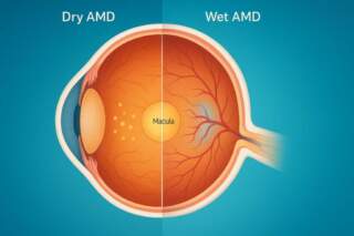 Timeline of Recovery Following Treatment for Central Serous Chorioretinopathy